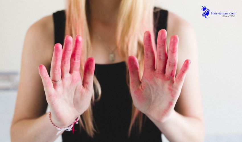 Understanding Hair Dye Stains on Skin