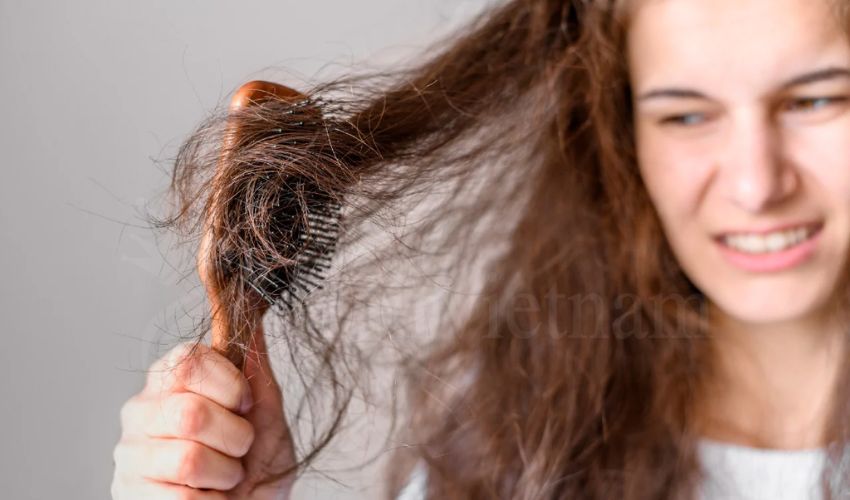 What causes Matted Hair?