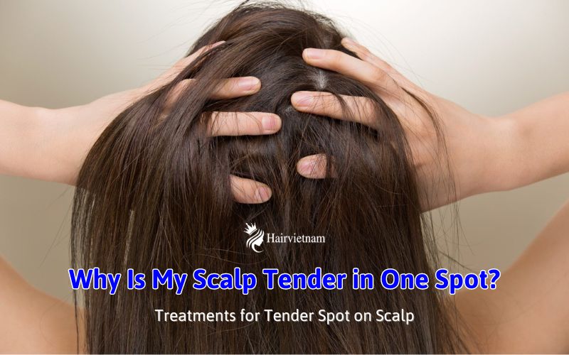 Why Is My Scalp Tender in One Spot? 